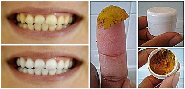 Be-Your-Own-Dentist-Heal-Cavities-Gum-Disease-and-Whiten-Teeth-with-This-Natural-Homemade-Toothpaste